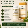 Clinol Capsules acne and oil control benefits for clearer skin
