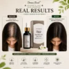 Hair Formula Results For Men Before and after hair growth results for men using Hair Formula Step One