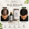Hair Formula Results For Women Before and after hair growth results for women using Hair Formula Step One